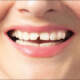 Tooth Pain