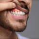 gingivitis